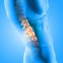 Degenerative Disc & Spine Treatment Specialist in Delhi