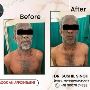 Best Solutions Skin Specialist in Behala Dr Sushil Singh