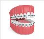 Get a Confident Smile with Clear Braces Near Me – Book with 