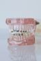 Braces for Mouth – Affordable & Reliable Options