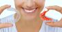 Affordable Retainer Orthodontics Cost in Charlotte, NC