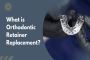 Get Your Retainer Replaced in Charlotte, NC 