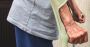 Top Hip Replacement Doctor in Vadodara - Expert Orthopedic C