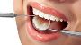 Tooth Colored Options in Hinjewadi | Dr Vikas Pakhare