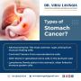Stomach Cancer Treatment in Ahmedabad Using ModernTechnology