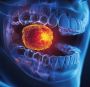 Best Cancer Hospital in Ahmedabad