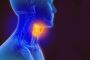 Trusted Head and Neck Onco Surgeon in Ahmedabad