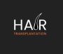 Hair Loss Treatments for Men | Male Hair Loss Treatment