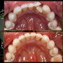Visit Dublin Dentist - Dublin Metro Dental    