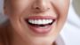 Teeth Whitening In Raleigh