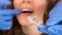 Invisalign Raleigh NC