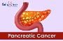 Looking for reliable Pancreatic Cancer Treatment?
