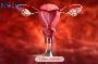 Looking for advanced Vulvar Cancer Treatment?