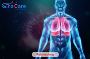 Pulmonology Treatment in India | Edhacare Medical Tourism