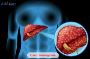 Liver Hemangioma Treatment in India with EdhaCare