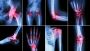 Custom 3D Orthopedic, Spine & Knee Replacement Implants by C