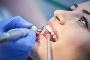 Teeth Cleaning: The Key to a Healthy Smile