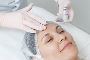 Peeling PRX T33 – Advanced Skin Rejuvenation at Elite Body H
