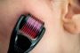 Buy Best Derma Roller Online - Elmask Beauty