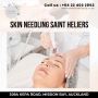 Skin Needling in St Heliers