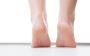Best Homeopathy Medicine for Cracked Heels