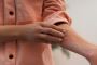 Best Homeopathy Medicine for Ringworm