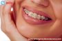 Top Rated Dentists in San Leandro, CA 94577 | Emergency Dent