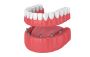 Dental Implants in Alaska | Emergency Dental Service