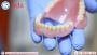 Emergency Dental in oaks-pa | Emergency Dental Service