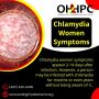 Chlamydia women symptoms