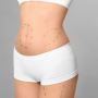 Get a Flatter, Toned Abdomen with Liposuction 360 in Marylan