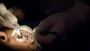Refractive Laser Eye Surgery in Faridabad