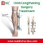 Discover the Limb Lengthening Surgery at Low Cost!