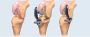 Get Affordable Joint Replacement Surgery at Leading Hospital
