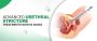 Minimally Invasive Urethral Stricture Surgery in Noida
