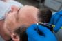 Revitalize Your Hair with Feller Medical’s Hair Restoration 