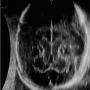 Exploring the Wonders of Fetal Neurosonography |  Fetal Indi