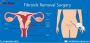 Affordable Fibroids Removal Surgery in India at We Care IVF 