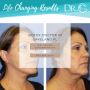 Botox Doctor in Lakeland FL | Dr. Jacob Gerzenshtein