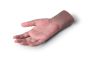 Advanced Hand Prosthetics in Phoenix, AZ | Custom Solution