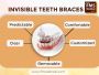 Invisible Braces in Hyderabad, India | Dental Braces