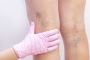 what kind of doctor treats veins