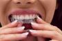 Invisalign Singapore: Achieve Your Perfect Smile Invisibly!