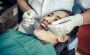 Composite Resin Fillings in Singapore – Natural Look & Feel