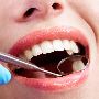 Genefitletics Oral Microbiome Test: The Future of Preventive