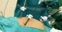 Best Hospital for Gallstone Surgery in Kolkata