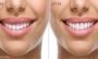 Gentle Dental Bateau Bay - Bateau Bay Dental Care