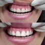 Gentle Dental Budgewoi - Invisalign Near me Budgewoi