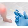 PRP Therapy Hair Loss Treatment AZ