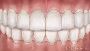 Get Best Dentist in Lethbridge: Gibb Orthodontics
